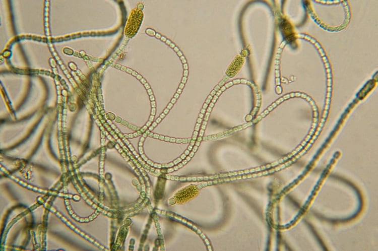 cyanobacteria-NNehring.jpg