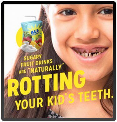 kids-rotting-teeth-square-375x391.jpg