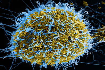 Ebola virus particles, marked in blue (NIAID/Flickr)