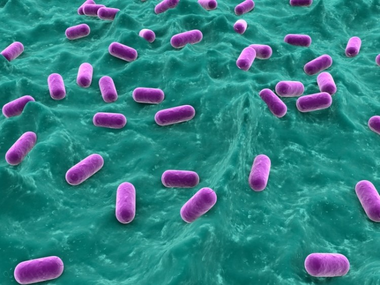 Nebraska Cultures joins rush to put probiotics into food with GRAS status on bacillus coagulans ingredient